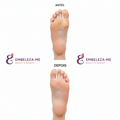 Removedor de Calos e Rachaduras - embeleza - me.com